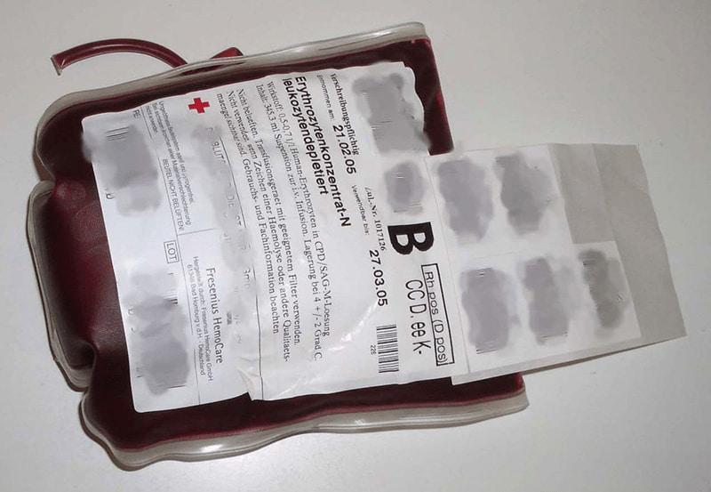 Nhóm máu B là gì? Đặc điểm của nhóm máu B
